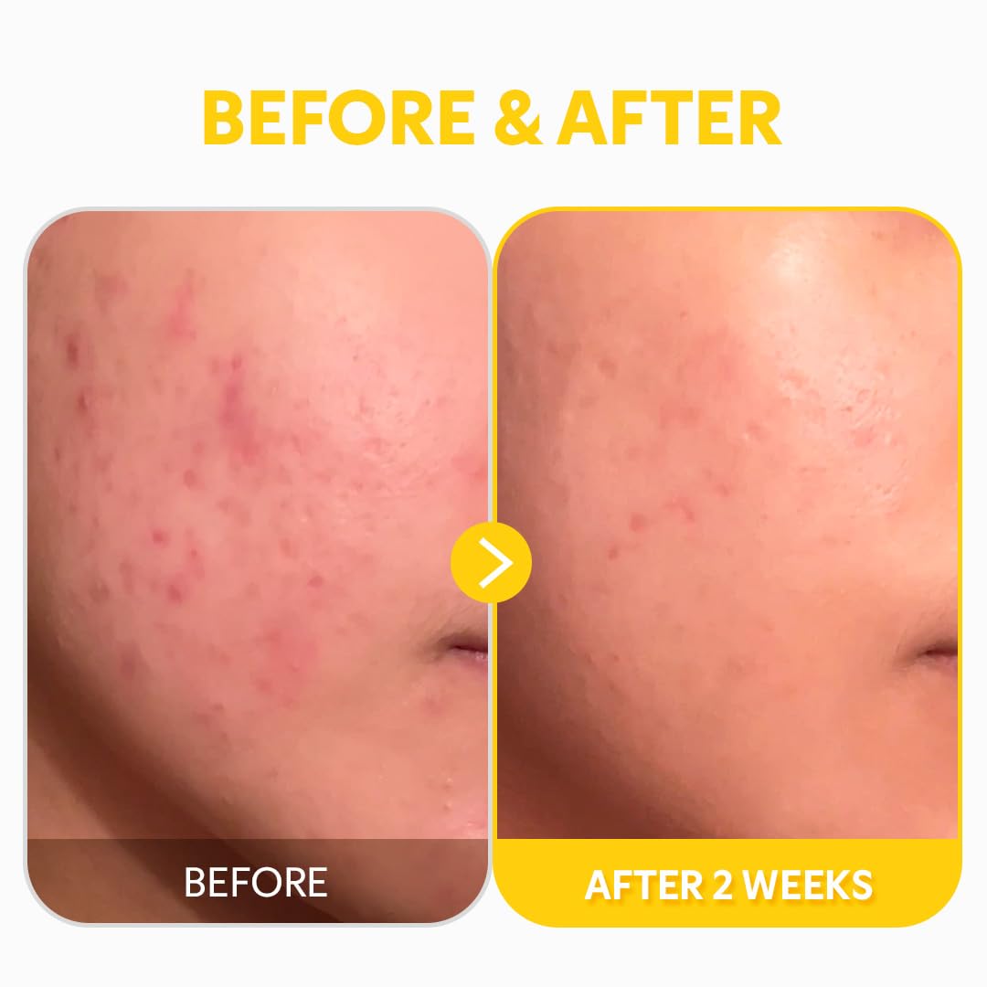 Beauty Of Joseon Ginseng Essence Water 150Ml